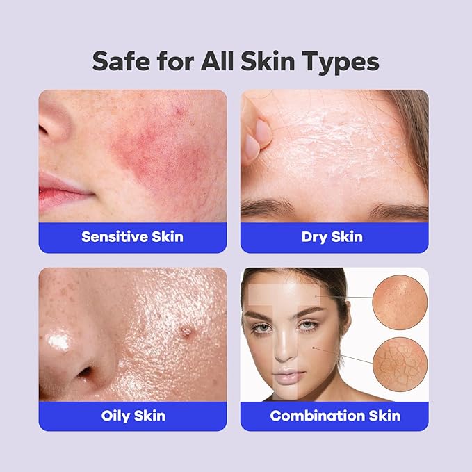Salicylic Acid Spray (5.07 Fl Oz), 2% Salicylic Acid Body Spray, Body Acne Treatment for Bacne, Blackheads & Blemishes, Back & Chest Acne Spray for Face & Body, 360° Mist for All Skin Types