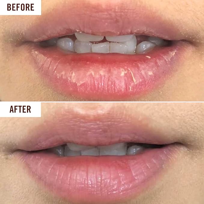 Hanalei Lip Treatment for Dry, Chapped Lips – Intensive Overnight Moisturizer with Kukui Oil, Shea Butter & Grapeseed Oil – Hydrating Balm for Healing Cracks – Clear Tint, Full-Size 15g – Cruelty-Free