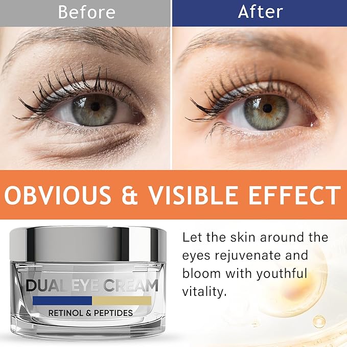 Eye Cream, Dual Eye Cream Anti Aging with Advanced Retinol and Peptides, Under Eye Cream for Dark Circles, Fine Lines, Puffiness and Bags Under Eyes