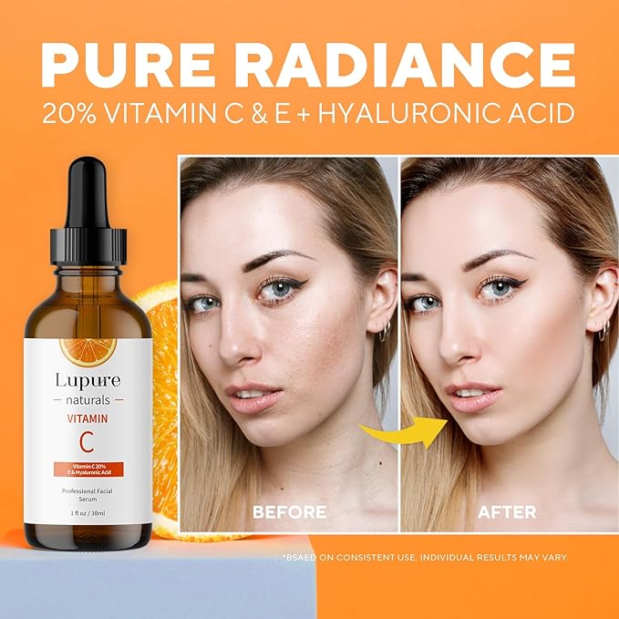Professional Vitamin C Face Serum 20%, Anti Aging Facial Super Vit C Serum with Ascorbic Acid Hyaluronic Acid & Vitamin E for Dark Spots, Skin Care, Christmas Gift & Stocking | 1 Fl. Oz