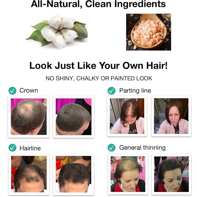Hair Thickening Fibers. Cover Bald Spot and Thinning Hair Instantly. Make Thin Hair Look 10X Fuller. All-Natural Hair Building Fiber. Trial Size (10-Day Supply). Silver/White