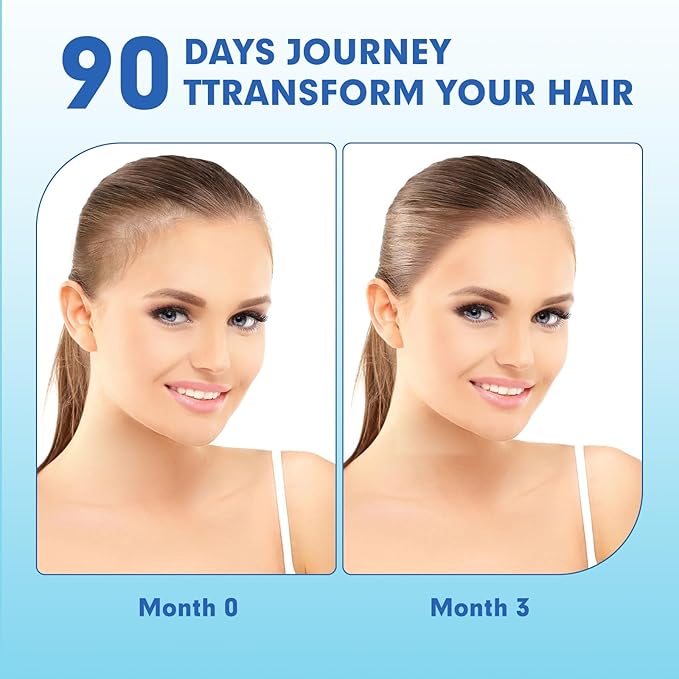 Postpartum Hair Loss Vitamin, Vegan Gummies with Biotin, Collagen, & Folate, Postpartum Hair Loss Products for Less Shedding, Thicker Hair, Stronger Hair, Breastfeeding-Friendly, 60 Gummies