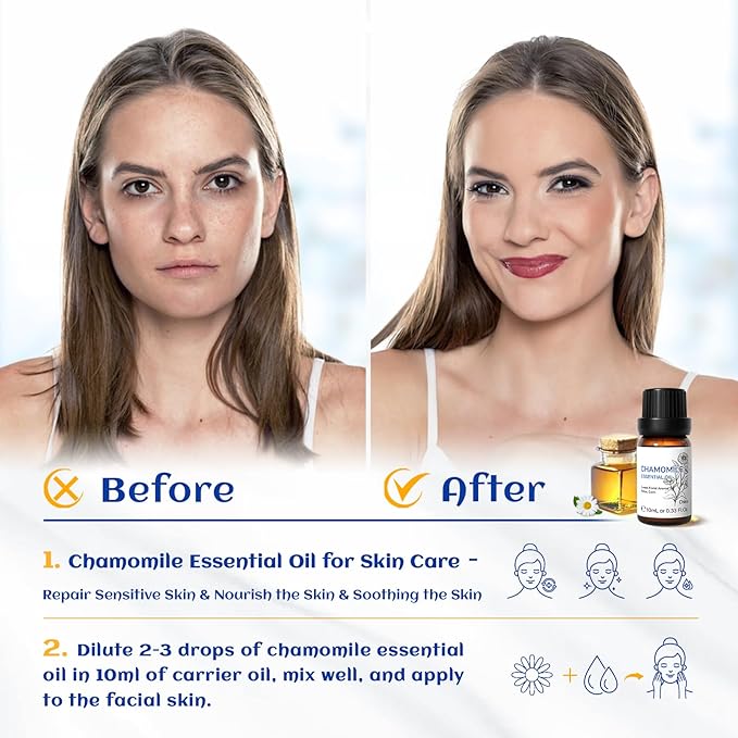 HIQILI 0.33 Fl Oz Chamomile Essential Oil, Air Purifying, Relaxing, Skin Care, Can be Added to Fresheners, Foot Baths, Body Lotions Use - 10ml