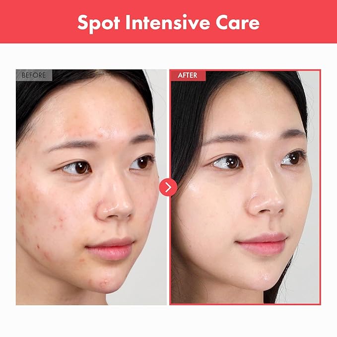 Ovalicin Skin Clear Cream, Skin Soothing, Moisturizing with Niacinamide and Sulfur, Korean Skincare, 50g, 1.76 oz.