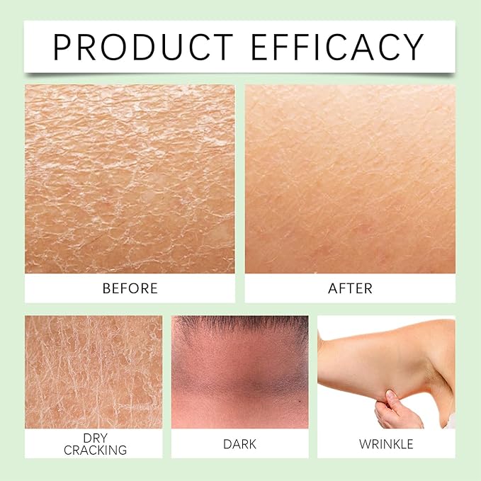 Body Lotion from Korea Whitening Remove Dark Spots, Original Niacinamide Whitening Body Lotion for Dry, Rough & Sensitive Skin, Moisturizing & Nourishing (2)