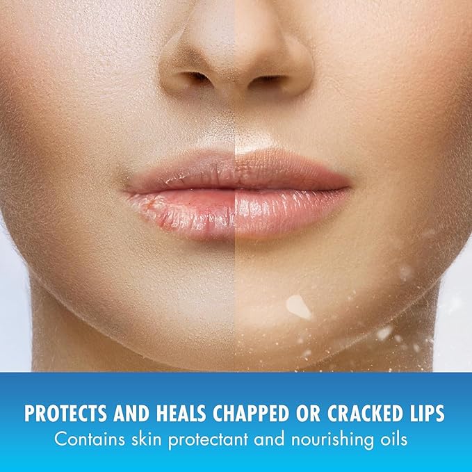 Natural Ice Medicated Lip Protect SPF 15 Cherry 12 Pkgs