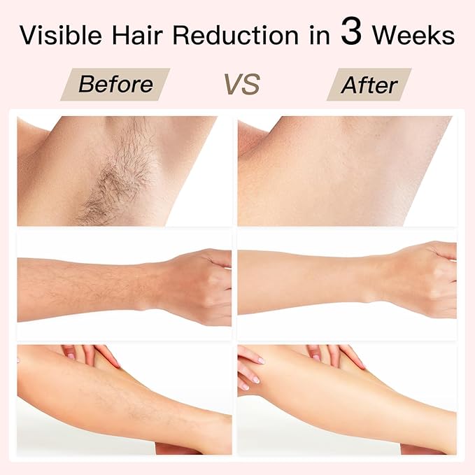 Laser Hair Removal, BoSidin IPL Hair Removal with Painless Ice-Cooling, 2-in-1 Face SR Rejuvenation, 6+1 Modes, 6 Levels Hair Removal for Women Permanent, Laser Hair Removal Kit with Shaver, Goggles