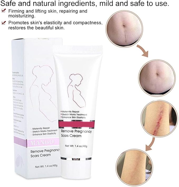 RtopR Stretch Marks and Scar Cream,Crema para Estrias De Embarazo,Stretch Marks Postpartum Repairing Cream Wrinkles Diluting Removal Cream Crema De Cacao para Cicatrices