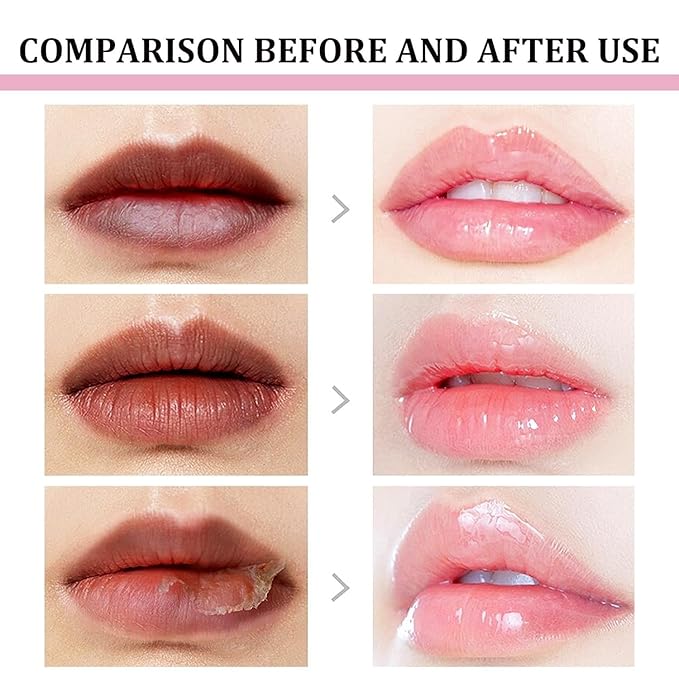 2pcs Lip Lightening for Dark Lips Lip Brightener for Smokers Dark Lip Treatment Lightening Cream for Pink Lips Lip Lightener for Smoker Lips Lip Lightening balm for Men and Women (Orange)