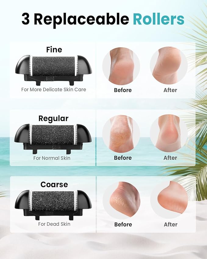 Electric Foot Callus Remover with 10000 RPM Motor and 3-Speed Settings, Foot File Kit with LED Light and Display for Women’s Home Pedicure, Waterproof Foot Grinder with Type-C Charging