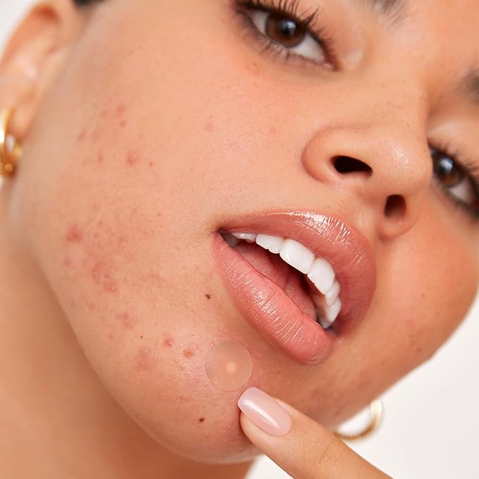 PEACE OUT Acne Healing Dots Helps Clear Blemishes Overnight, Fast Acting Hydrocolloid Pimple Patches for Breakouts with Salicylic Acid, Retinol and Aloe Vera, Award Winning Skincare Solution 20 Count