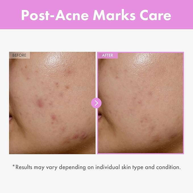 9 Peptide Skin Booster Serum, Niacinamide & Hyaluronic Acid Skin Renewal Boosting Facial Essence for All Skin Types, Korean Skin Care, Paraben Free, 150ml, 5.07 fl.oz.