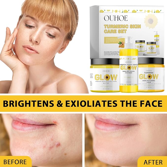 Glow Combo Skincare Set,3 In 1 Turmeric Combo Skincare Set，Turmeric Glow Butter, Skincare Gift Set For All Skin Type (1 Set)