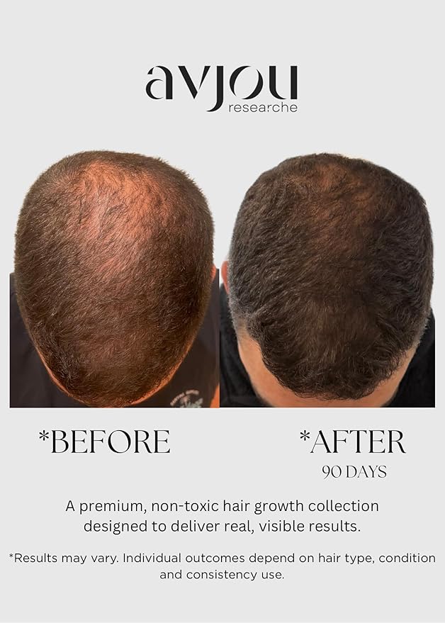 Avjou Researche™ Scalp Serum – Thicker, Fuller-Looking Hair + Targets Visible Signs of Premature Greying – 3 Patented Ingredients – Backed by Cosmetic Science – Oil-Free, All Hair Types, 1.7 oz