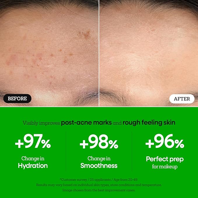 Nature Republic The First Peptide Boosting Serum, 8 Peptides, Niacinamide & Triple Hyaluronic Acid Complex,17 Amino acids,for All Skin Types, Korean Skin Care150ml/5.07 fl oz