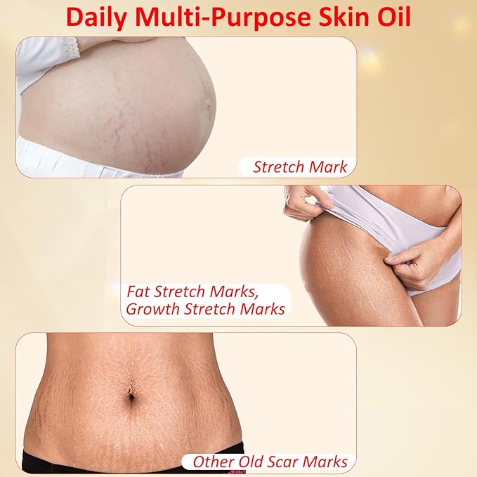 Stretch Mark Oil for Pregnancy, Skincare Body Oil for Scars and Stretchmarks, Pregnancy Oils for Stretch Marks Pre and Postpartum Natural Skincare Massage Oil, Skin Regenerate Oil, 4.2 fl.oz