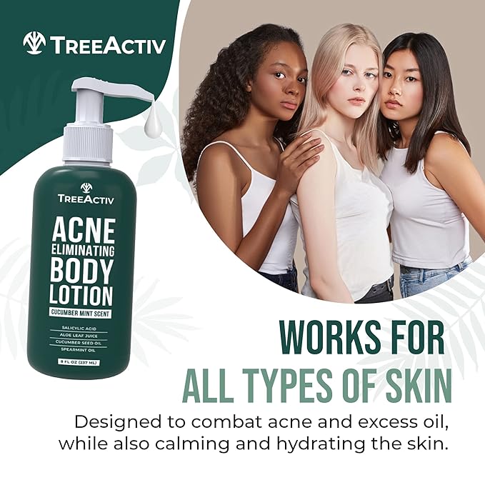 TreeActiv Acne Eliminating Body Lotion 8 fl oz | Clears Body, Back, Butt and Shoulder Acne | Anti-Acne Moisturizer | Prevents Future Breakouts | Cucumber Mint Scent