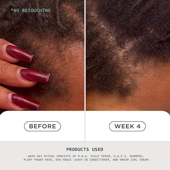 Sienna Naturals - D.N.A. Scalp Serum – Hair Growth Serum for Thinning Hair, Scalp Repair & Strength – Nourishing, Active Treatment for Scalp Health with Biotin & Rosemary– 1 oz