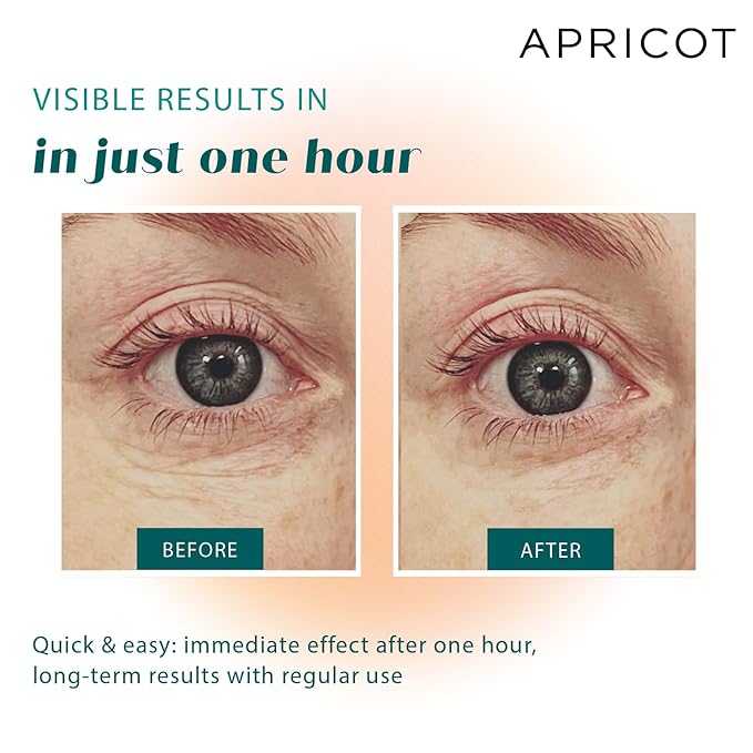 APRICOT Eye Patches with Hyaluronic Acid (pack of 1) I Anti-Aging Eye Pads "Me,Myself and Eye" I Reduces eye wrinkles I Reusable eye patches I Silicone pads against wrinkles I Made in Germany