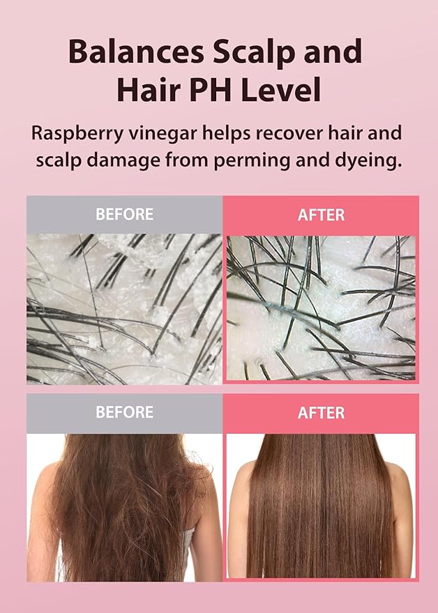 A’PIEU Raspberry Vinegar Hair Shampoo 16.9 fl.oz / 500 ml - Dandruff & Clarifying Shampoo | Scalp Treatment I Korean Hair Care I Balances pH, Removes Buildup, Soothes Scalp