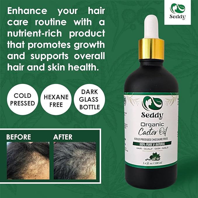Seddy Organic Castor Oil - Cold Pressed | Hexane-Free | Pure | Hair, Scalp, Eyelashes, Eyebrows, Skin, & Nails | Hair Treatment Oil - 3.4 Fl. Oz