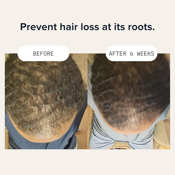 Hair Growth Conditioner for Men by CARDON, Prevent Thinning Hair and Hair Loss with Niacinamide & Vitamin B5 for healthy scalp, Korean Skin care, Deep Conditioner for dry damaged hair, (1 Bottle)
