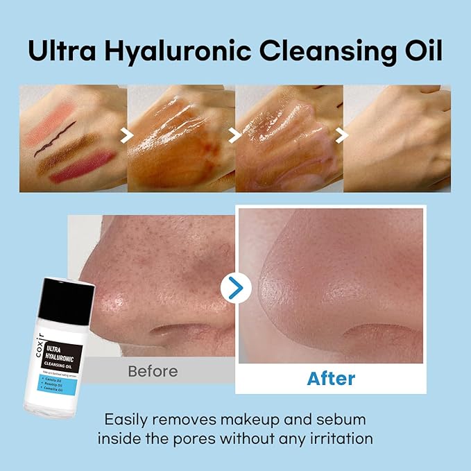 coxir ULTRA HYALURONIC STARTER KIT /cleansing oil+toner+ampoule+cream tralvel kit/[2.68 fl.oz (Pack of 1)]