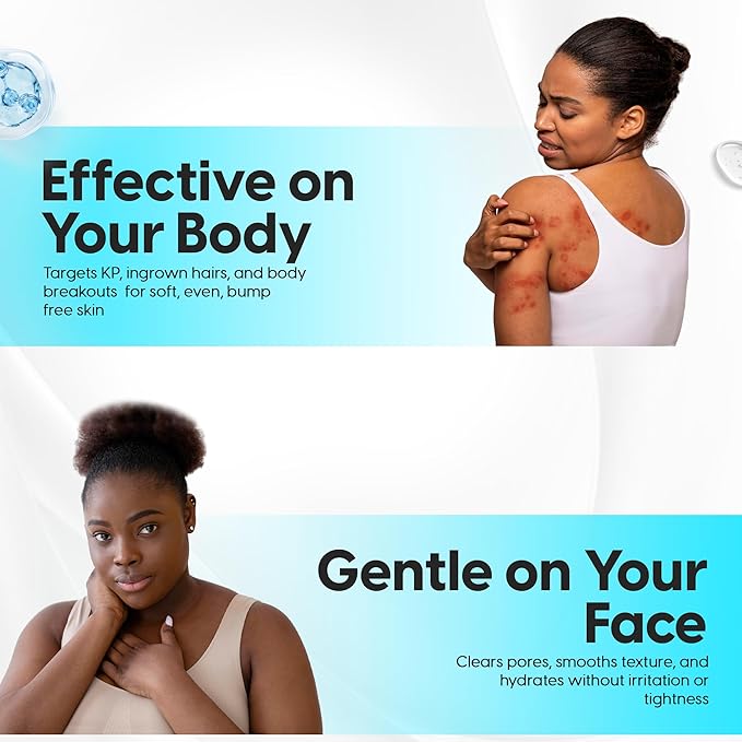 5% Lactic Acid + 2% Salicylic Acid Cleanser –Non-Stripping AHA/BHA Exfoliating Face & Body Wash With Ceramides. Minimizes Pores, Keratosis Pilaris, Acne, Ingrown Hairs & Psoriasis-200ml.