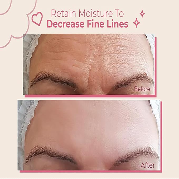 Forehead Wrinkle Patches | Non-Invasive Reusable Skin Care Solution | Fine Lines and Wrinkles Smoothing | Pairs with Eye Patches and Face Tape | Long-Lasting Skin Pads for a Smoother Look | Pack of 2