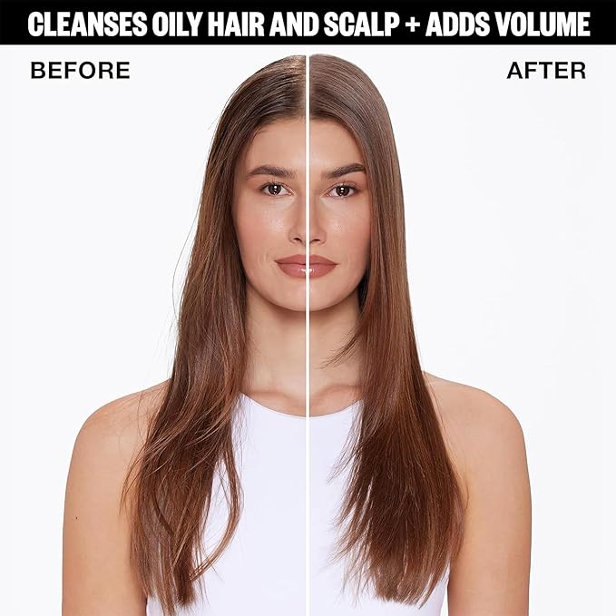 IGK FIRST CLASS Charcoal Detox Dry Shampoo | Volume + Soothes Scalp + Balance Oil | Vegan + Cruelty Free | 6.3 oz (Pack of 2)