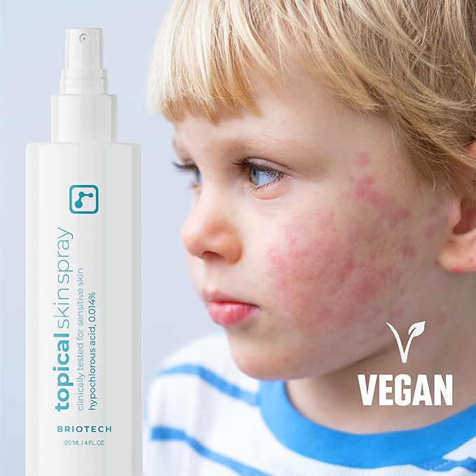BRIOTECH Topical Skin Spray, Hypochlorous Acid Spray for Sensitive Skin, HOCl Facial Mist, Full Body Support Against Irritation, Calm Redness, Soothe Foot & Scalp, 8 oz (2 Pack)