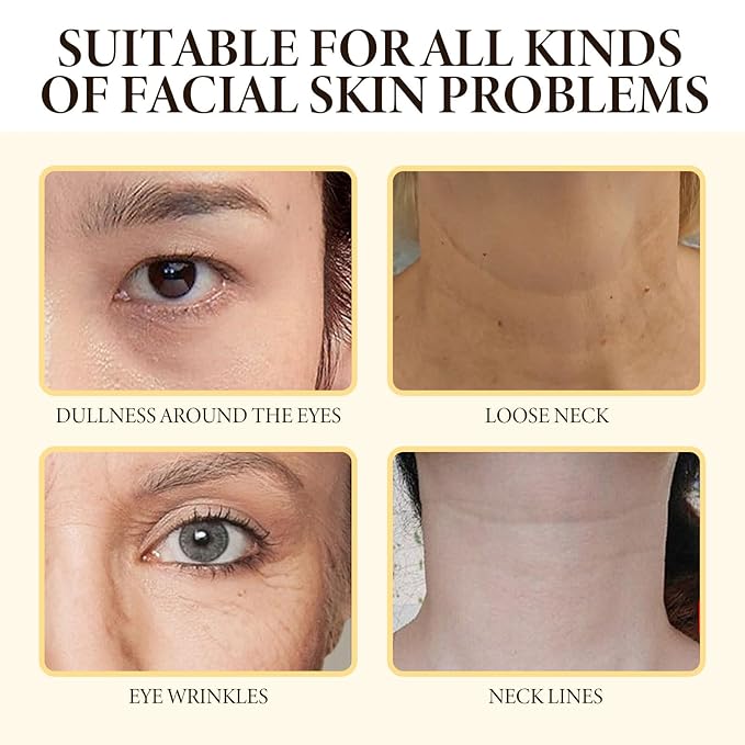 Bee Venom SkinCare Set, Includes New Zealand Bee Venom Face Lotion, Bee Venom Essence, Bee Venom Face Cream, Bee Venom Eye Cream, Anti-Wrinkle, Hydrating & Firming, Plant-Based Formula