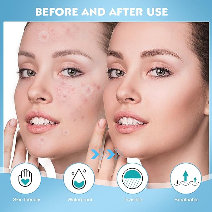 Pimple Patches for Face - 360 Counts Hydrocolloid Acne Patches Salicylic Acid with Tea Tree Oil for Zit Blemish Spot Covers Invisible Hydrocolloid Patches Pimple Acne Stickers