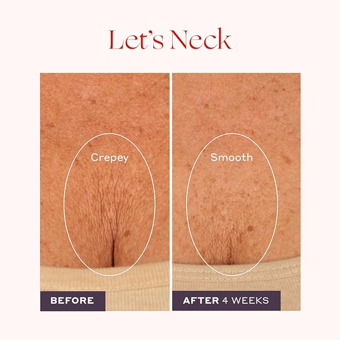 Womaness Let's Neck Firming Serum - Hydrates, Lifts, and Smoothes with Cooling & Massaging Roller Applicator - Cream for Women to Smooth Wrinkles & Tightening Sagging Skin - 50ml Roller
