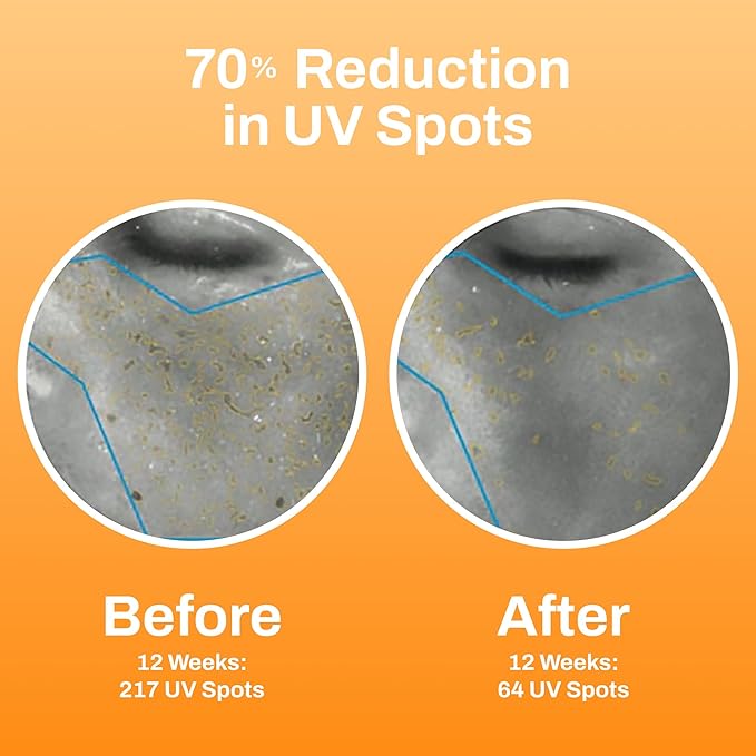 Photozyme DNA Youth Recovery Facial Serum | 0.5 Fl Oz