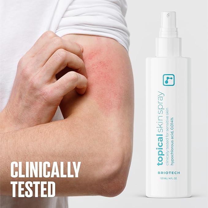 BRIOTECH Topical Skin Spray, Hypochlorous Acid Spray for Sensitive Skin, HOCl Facial Mist, Full Body Support Against Irritation, Calm Redness, Soothe Foot & Scalp, 8 oz (1 Pack)