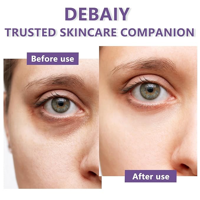 3 Pack Eye Cream Hydrating & Repairing with Hyaluronic Acid & Peptides - Moisturizes, Smooths Fine Lines, Enhances Elasticity (Each 0.529oz | 15g)