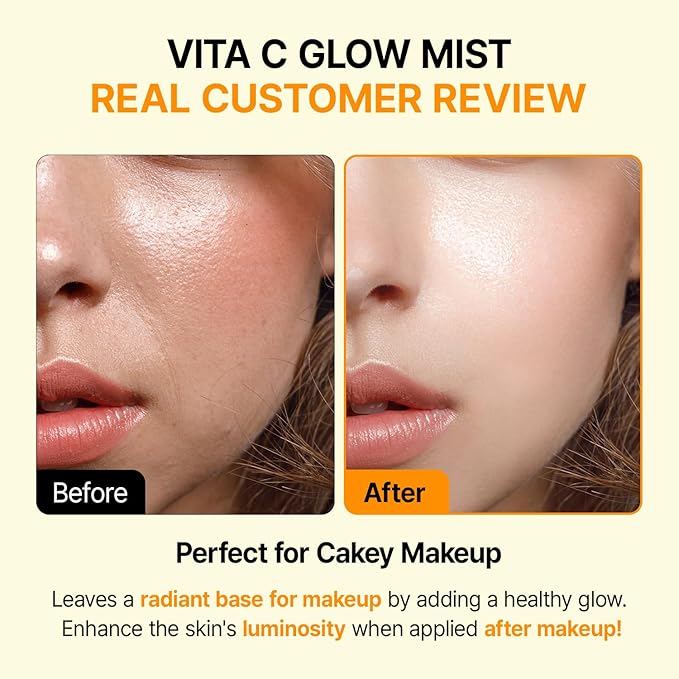 Vitamin C Mist with Niacinamide & Glutathione, Glow Mist for Dewy Skin, Makeup Setting Spray for face, Korean Skin Care, Vegan, 3.38 Fl Oz