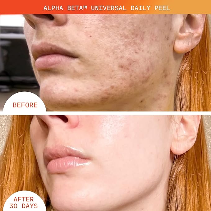 Dr Dennis Gross Plump It Up Kit: 3 Piece Dry Skin Essentials Set: Includes Hyaluronic Marine Moisture Cushion, Universal Daily Peel 10 App, Hyaluronic Marine Meltaway Cleanser