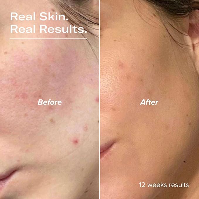 PLUMP Hyaluronic Acid Serum with 5D Hyaluronic Complex, Ectoin, Plant Ceramides, Vitamins B5 & E, Deep Hydration, Strengthens Skin Barrier, Fragrance-Free, 1 fl oz