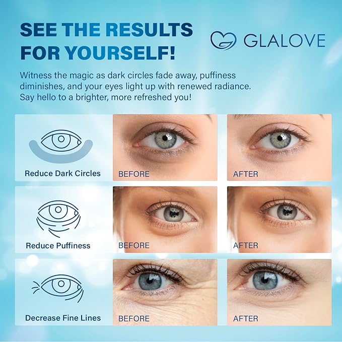 Under Eye Patches for Dark Circles: 60 Count Retinol Collagen Eye Gels Pads - Reduce Wrinkles, Puffy Eyes, Eye Bags - Skin Treatment Mask for Anti Aging & Face Moisturizer 1