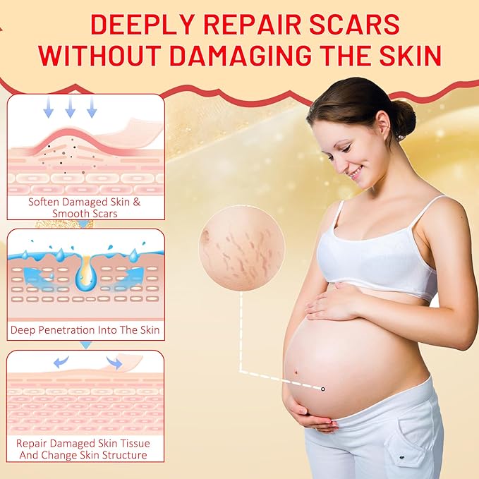 Stretch Mark Oil for Pregnancy, Skincare Body Oil for Scars and Stretchmarks, Pregnancy Oils for Stretch Marks Pre and Postpartum Natural Skincare Massage Oil, Skin Regenerate Oil, 4.2 fl.oz