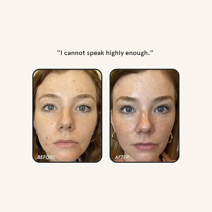 Barefaced Retinal Skin Therapy 30ml - Retinaldehyde & Bakuchiol Serum for Firming, Reducing Fine Lines & Wrinkles, Improving Skin Tone & Texture w/ Shea Butter, Jojoba Oil & Argan Oil