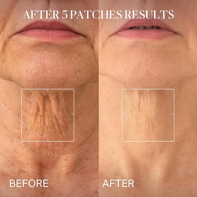 depology Tightening and Lifting Neck Wrinkle Patches with Cream, PDRN Deep Collagen Neck Mask, Firming Patch with PDRN、Collagen and Niacinamide Cream
