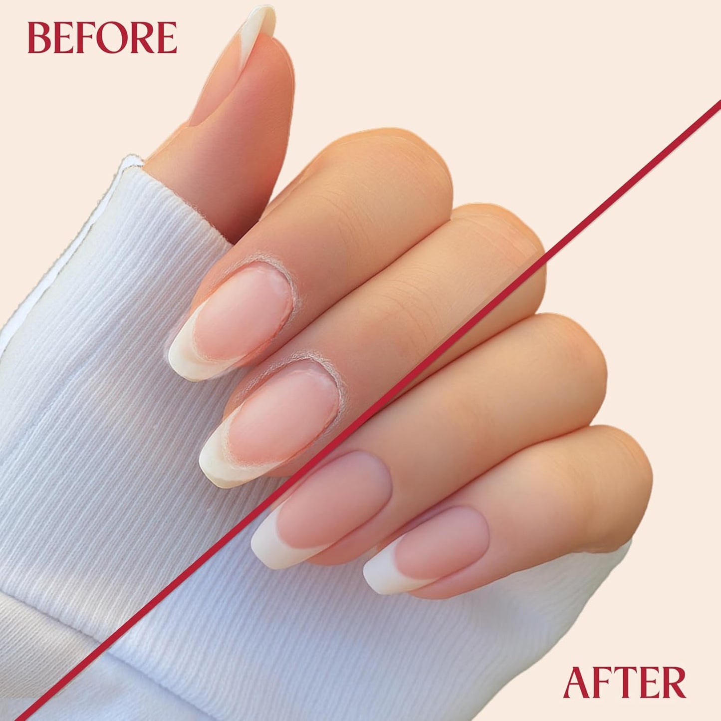 C CARE Pomegranate and Fig Roll-On Cuticle Oil | Natural Revitalizing Hydrating Nail Oil | Repaires Cuticles Overnight | Remedy For Damaged Skin And Thin Nails | Paraben Cruelty Free Formula | 10ml