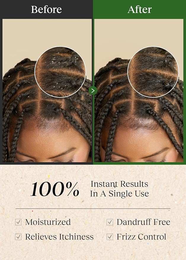 Braid Rev Scalp Cleansing Toner for Braiding Hair, Apple Cider Vinegar Scalp Treatment Exfoliator, No-Rinse, Scalp Treatment for Dry & Itchy, Moisturizing Braid, Detoxify, 6.76 Fl Oz