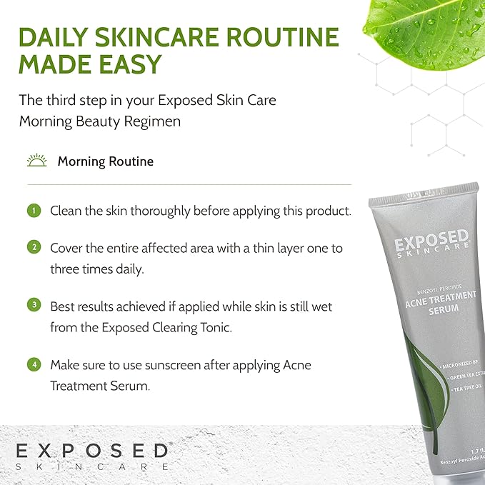 Exposed Skin Care Acne Treatment Serum Step 3 – Quickly Reduces Pimple Size and Redness - 12 Hour Spot Treatment - 3.5% Benzoyl Peroxide, Natural Green Tea & Tea Tree Oil