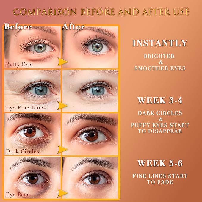 24K GOLD Eye Mask– 60 Pcs - Gold Under Eye Mask Retinol & Collagen - Puffy Eyes and Dark Circles Treatments – Look Younger and Reduce Wrinkles and Fine Lines Undereye