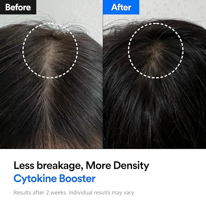 Hair-Recovery Cytokine Booster, 3.38 Fl.Oz.– Hair Regrowth Tonic for Thinning Hair, Hair Loss Treatment, Stimulates Follicles, Thicker, Stronger Hair (Sensitive)