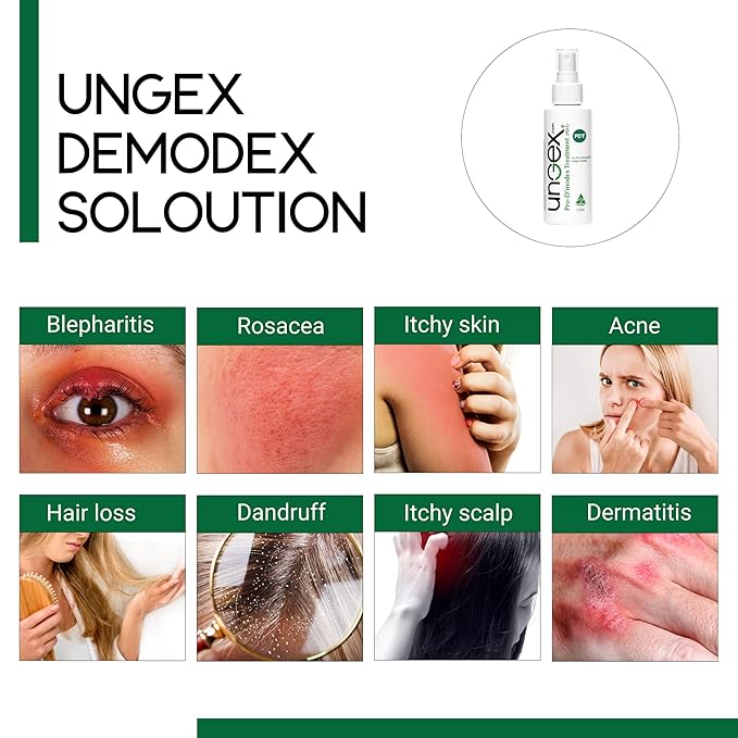 Basic Kit-i | Demodex Solution For Acne Rosacea, Itchiness, Redness | Ungex